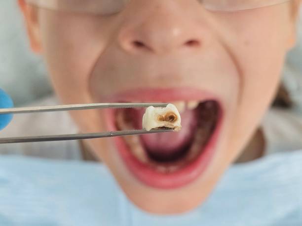 Best Broken Tooth Emergency  in Breezy Point, MN