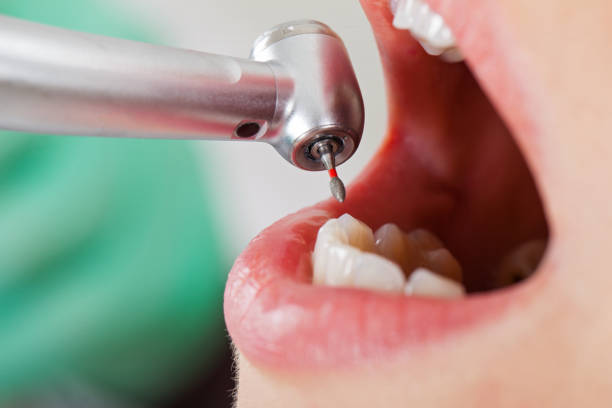 Best Tooth Infection Emergency Dentist  in Breezy Point, MN